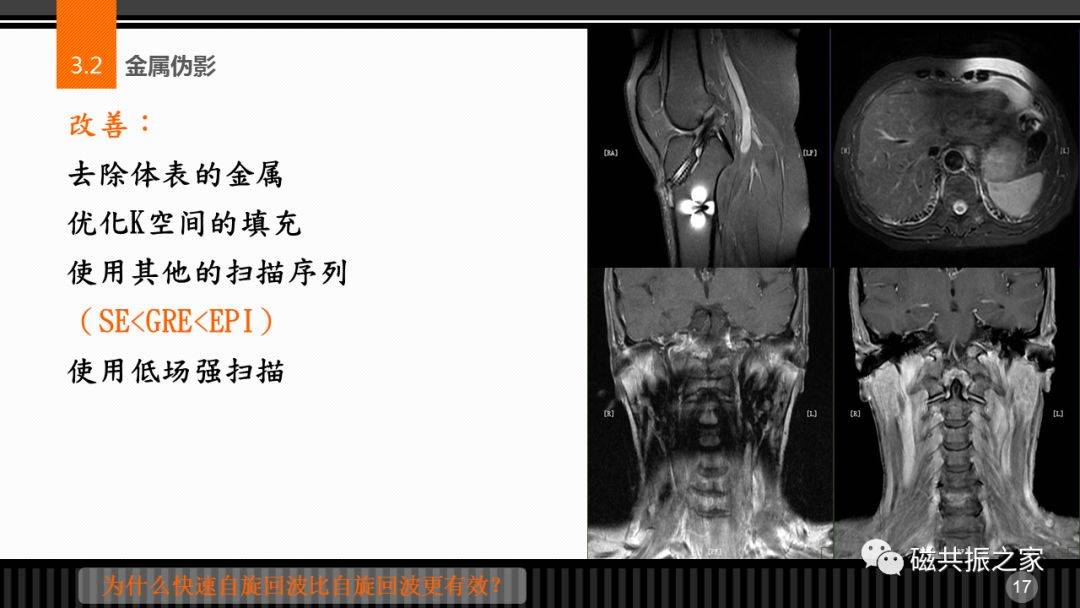 磁共振常见伪影及策略