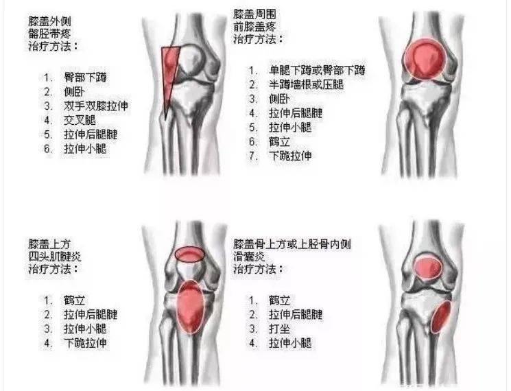 谈"骨"论"筋" | 趁年轻,把膝关节保护好