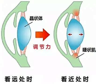 孩子一旦确诊为真性近视还能恢复正常视力吗