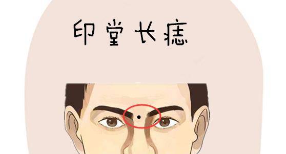 印堂位于两眉头中间的位置,又被称之为命宫,代表的是一个人的事业运势