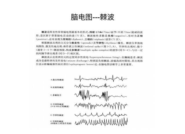 儿童脑电图基础与判读解析