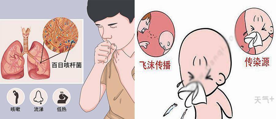 儿童百日咳的预防与治疗_细菌