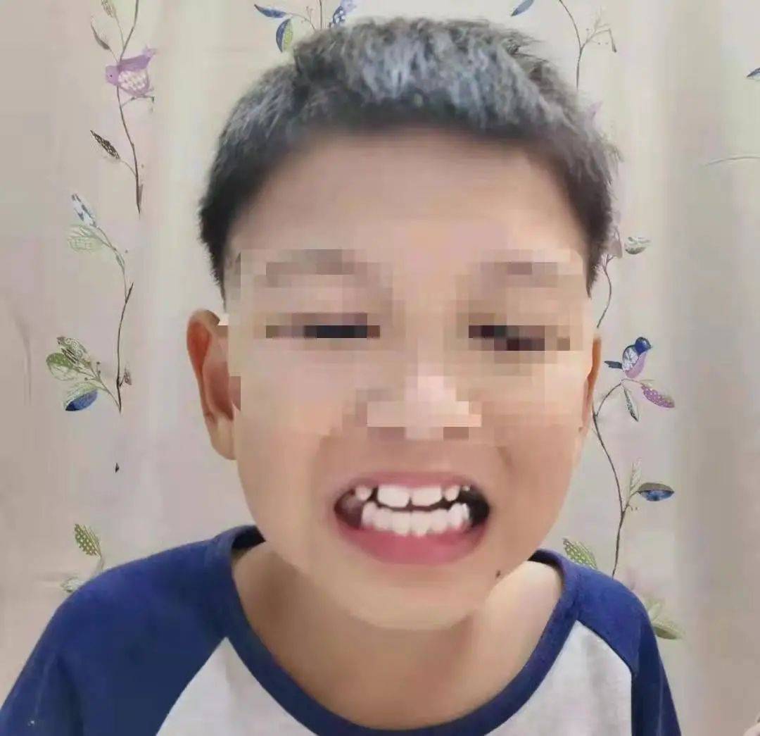 一口烂牙却死活不进牙科,自闭症孩子有"牙医恐惧症"怎么办?