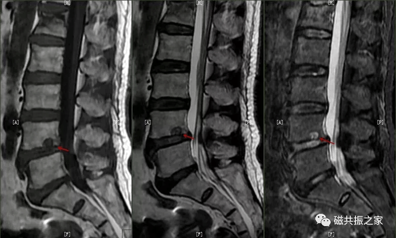 这些腰椎病变都不知道你还敢说你是技术界的老司机