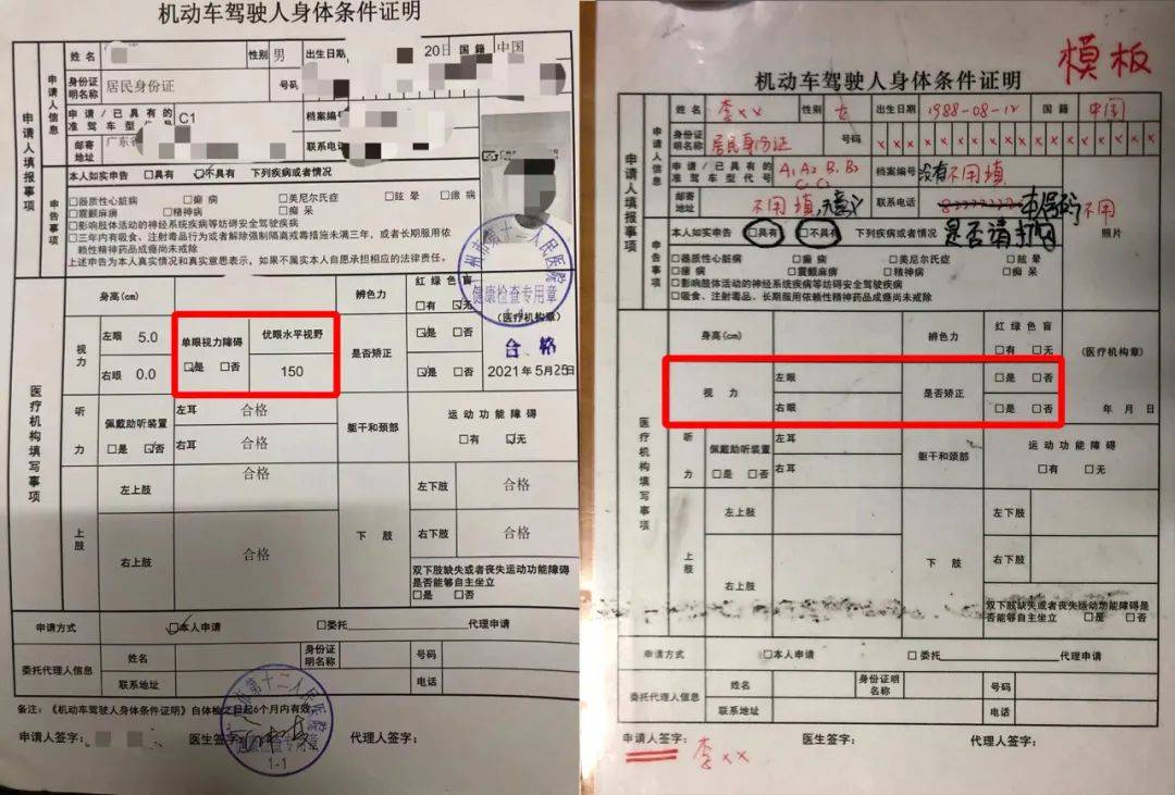 另外,驾驶员单眼150度检查的费用是180元.拍照25 体检20 病历本1.