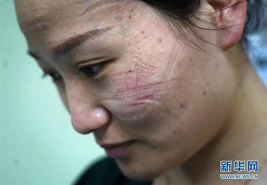 《埃博拉前线》影评:触目惊心!这剧什么时候才能播啊!