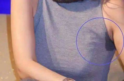 不活动也出汗!这些出汗异常的表现,都预示哪些问题?速看
