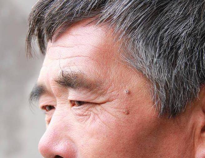 眉毛决定寿命长短?出现此"异常"信号,可能是生病前兆!