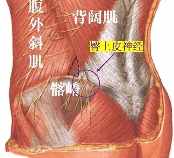 "小技术"解决"大问题"——"可视化"刃针治疗臀上皮神经卡压综合征