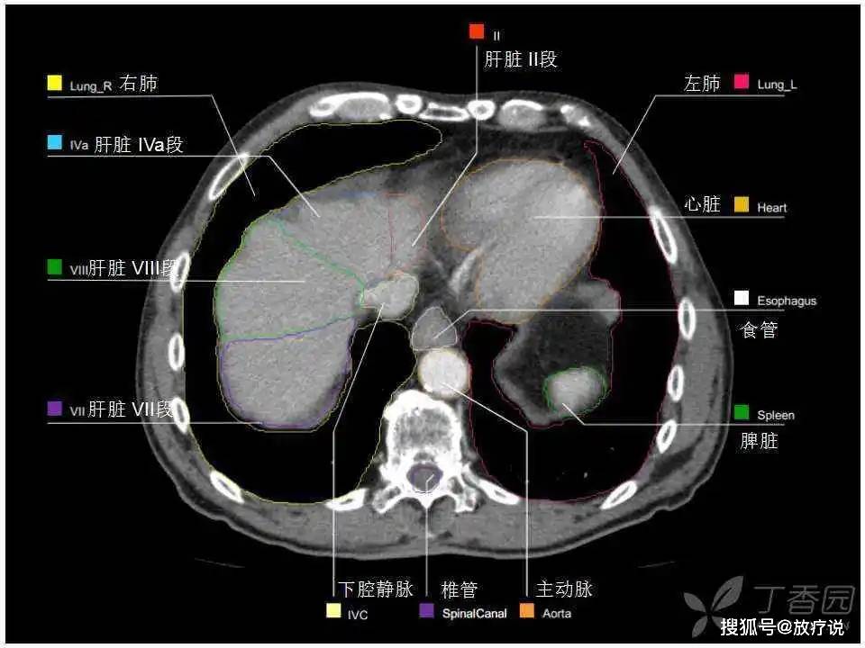 经典高清 | 最实用的上腹部 ct 影像解剖图谱,看过的医生都收藏了