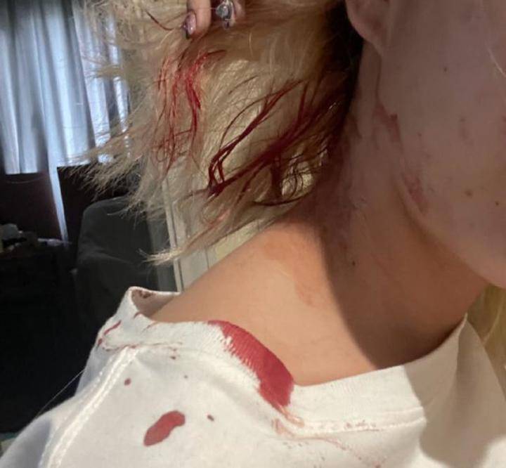 女网红遭男友家暴,点赞又一女孩发声曾被打,男方曾自比衣冠禽兽?_小熊