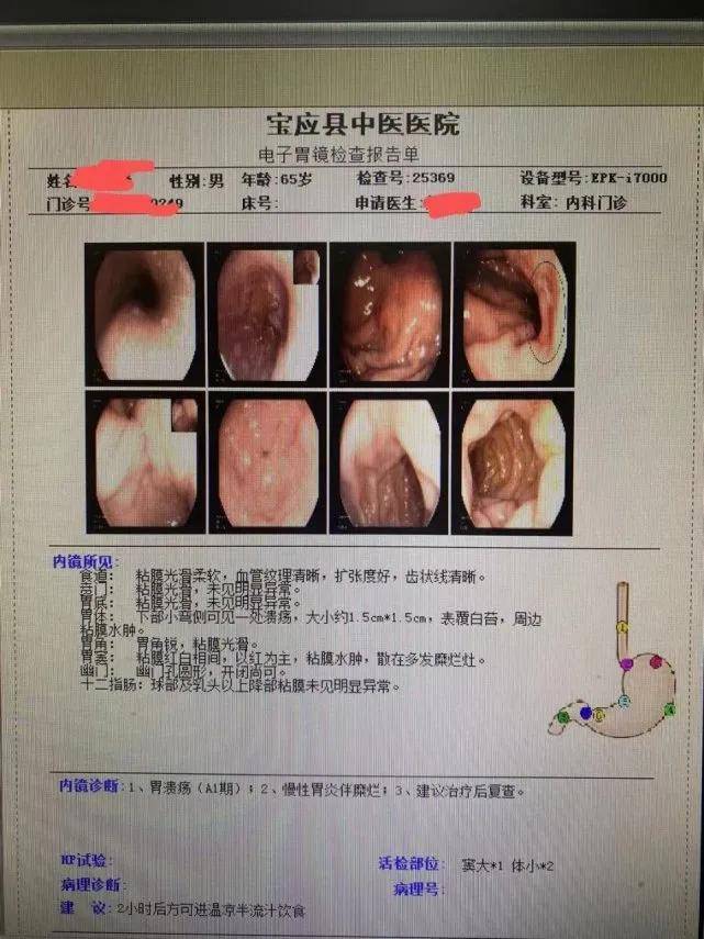 小小胃溃疡,半年变胃癌!|武汉胃肠医院