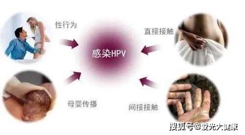 你不了解的hpv病毒,三大主要感染途径!