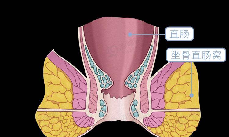 排便时,肛门掉出一块肉是怎么回事?这5类人易被"脱肛"