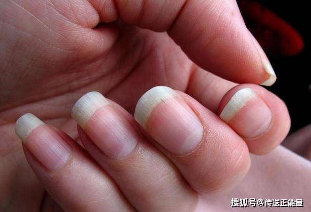 2,手指关节变大