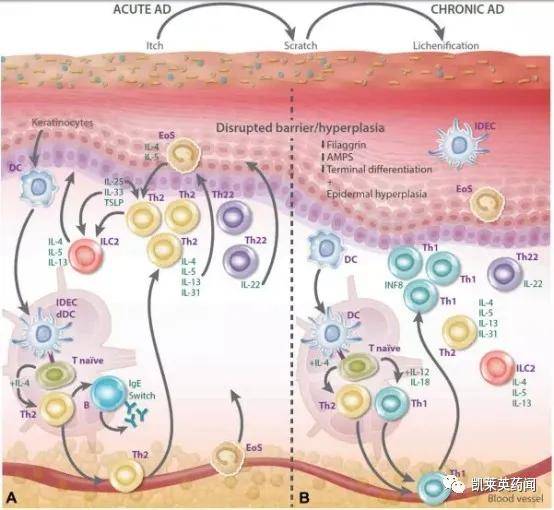 特应性皮炎的致病机制,至今尚未完全明确,但最被认可的,是免疫系统的