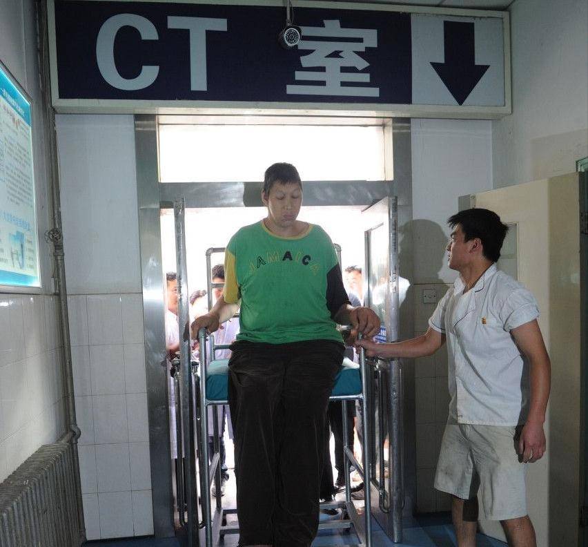 原创中国第一男巨人王峰军:身高2.55米,比姚明高一头,如今怎么样了