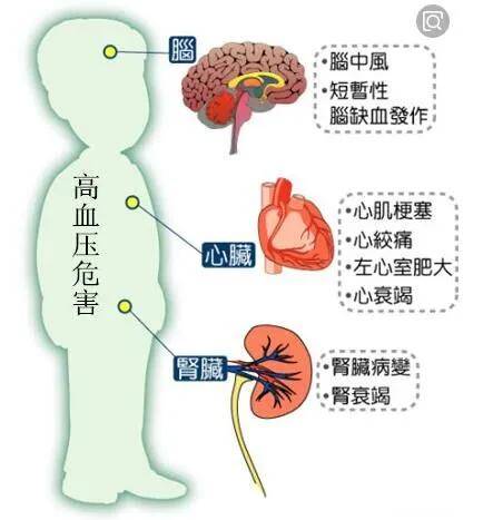 控制高血压预防并发症干细胞掌控隐形杀手