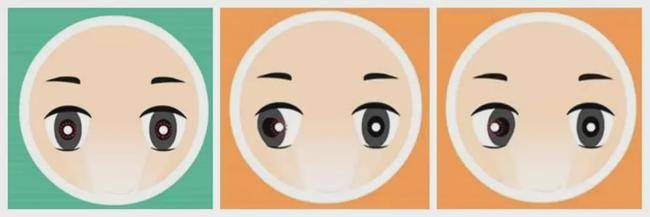 小儿斜视手术的年龄有要求吗?