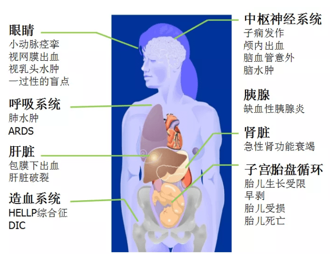 怀孕期间经常出现头晕头痛、眼花、水肿？别磨蹭,赶紧到医院！