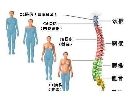 李慧英主治医师:脊髓损伤了怎么办?脊髓损伤怎么治疗好?