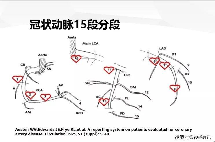 69房室结动脉80%来于右冠状动脉,20%来源于左冠状动脉69窦房结由