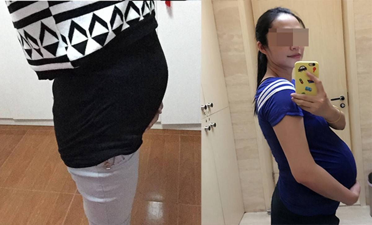 孕妇的肚型暗示生男生女？别被懵了,孕肚上怀和下怀二者区别在此