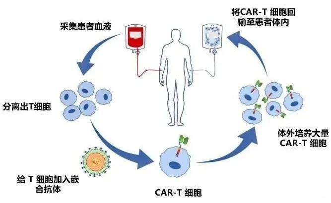 120万一针湖南省肿瘤医院首张抗癌cart细胞疗法处方开给了她