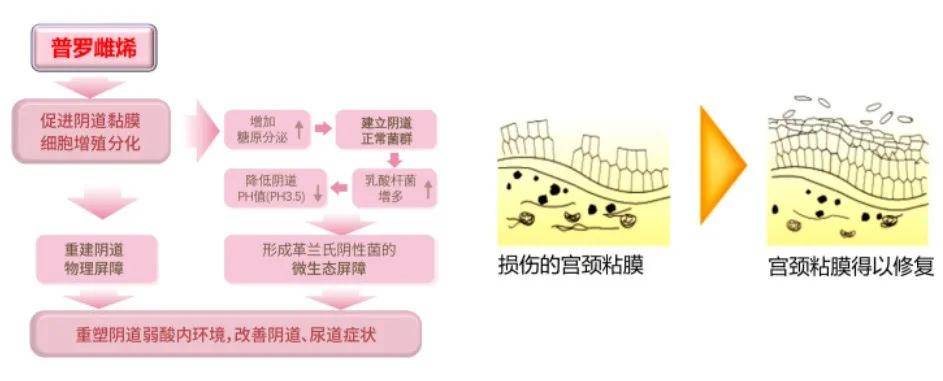 上市安全性最高的雌激素普罗雌烯阴道用软胶囊/乳膏成分:普罗雌烯剂型