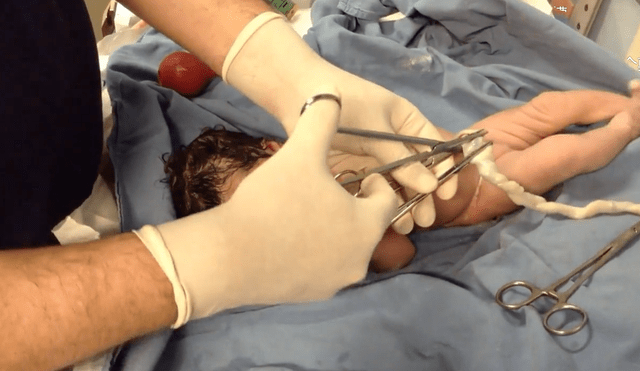 宝宝出生后多久剪脐带、怎么剪断、剪断时疼痛不疼,家长一文了解