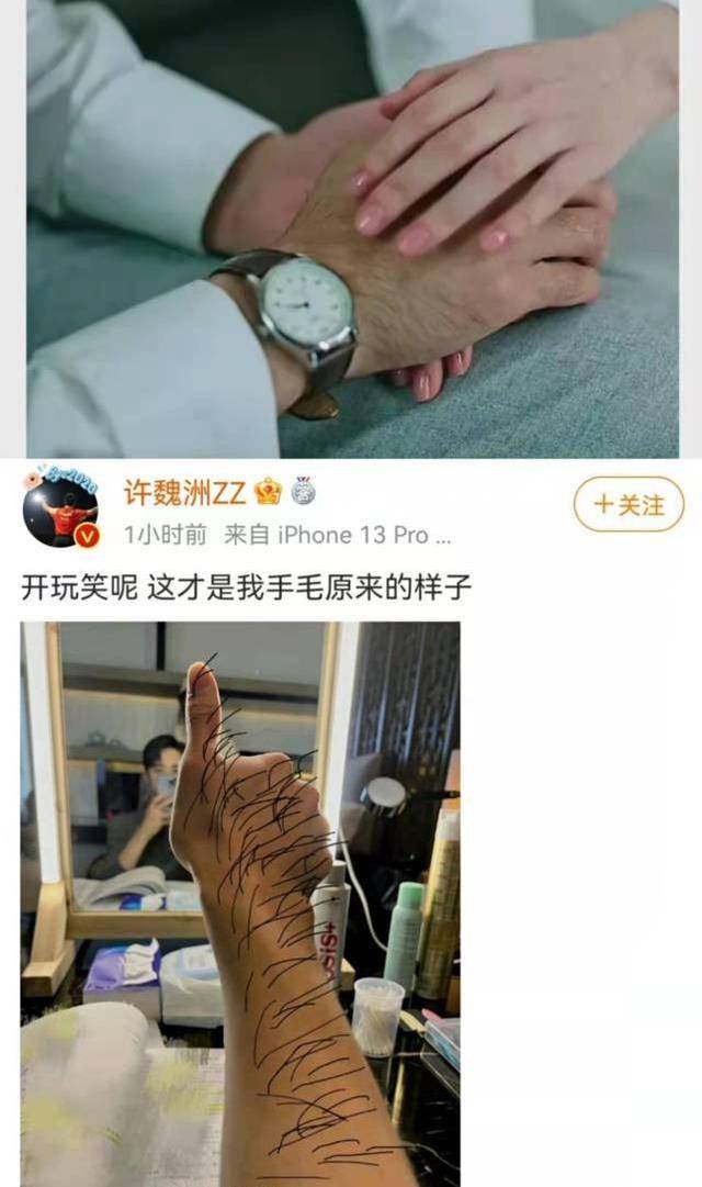 原创许魏洲回应新剧手毛长晒图称这才是我手毛原来的样子