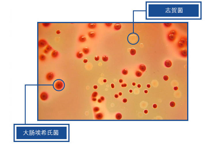 食品微生物检验志贺氏菌检验常用培养基原理解析_试验