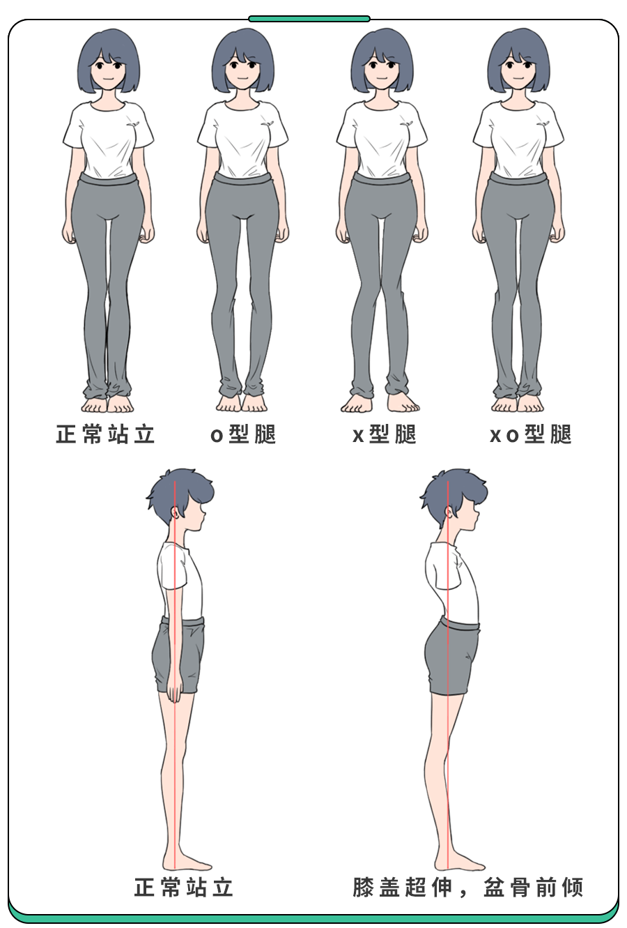 小腿粗壮、减不下去？可能是＂扁平足＂惹的！3招有效锻炼