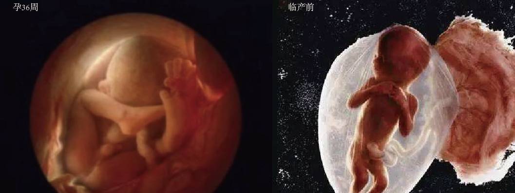 原创胎儿形成全过程10张高清图片带你了解感受生命的神奇
