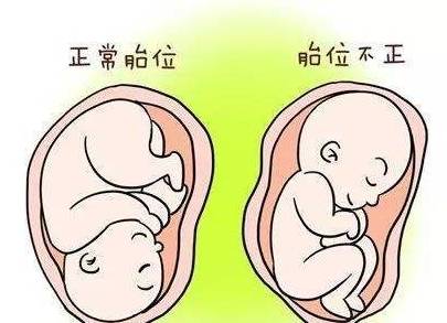 怀双胞胎的准妈妈,顺利度过孕期,这些可能出现的情况要早知道!