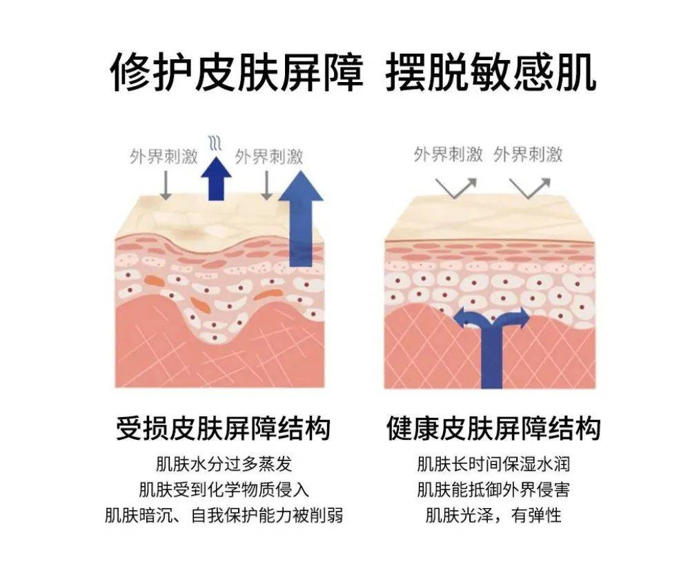 面子智能美肤特别打造"敏感肌"克星「gos肌底修护管理」重构肌肤屏障