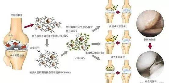 细胞治疗丨关节腔注射干细胞后关节软骨持续再生