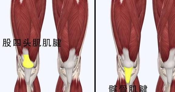就会让股四头肌肌腱和髌骨肌腱造成损伤,使得膝盖髌骨上方和