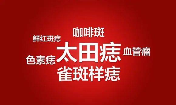 太田母斑,伊藤母斑,青色母斑棕色胎记:咖啡牛奶斑,贝克氏母斑红色胎记