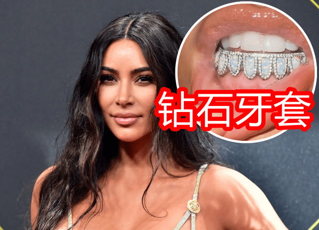 金卡戴珊另类炫富方式牙齿上镶满钻石球迷一张嘴就是钱