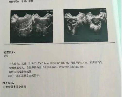 广州助孕公司（中医调理女性不孕，助您好“孕”降临）