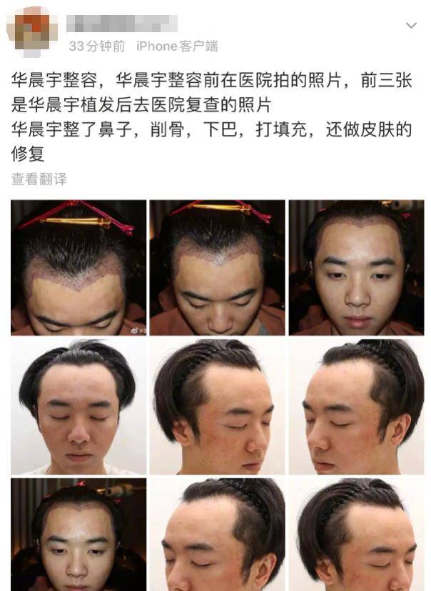 事实证明，华晨宇在“自我膨胀”的道路上越走越远