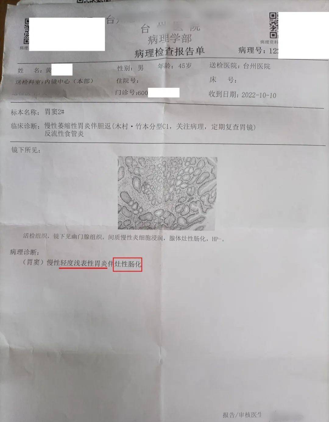 43岁男子胃部中重度肠化，中药辨证调理，逆转为灶性肠化