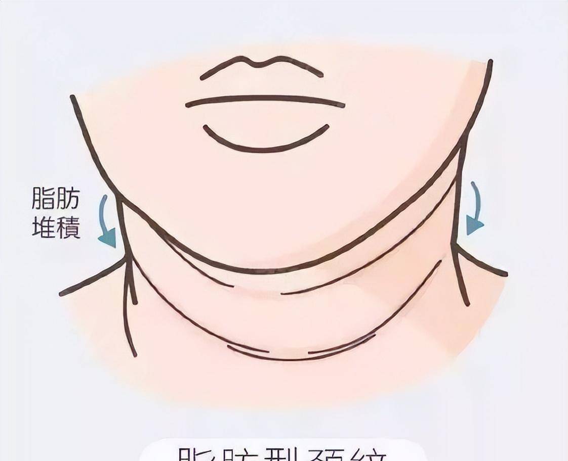 身材决定寿命？研究发现：脖子粗、肚子大的人，可能与长寿无缘