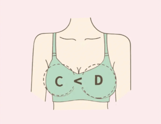 导致乳腺发育不良引起比较明显的大小胸，那么假体丰胸该如何去改善呢？我们可以通过匹配不同的大小假体来改