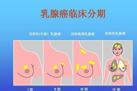 中国妇女的第1杀手，乳腺癌居然这么可怕？几招儿教你远离他