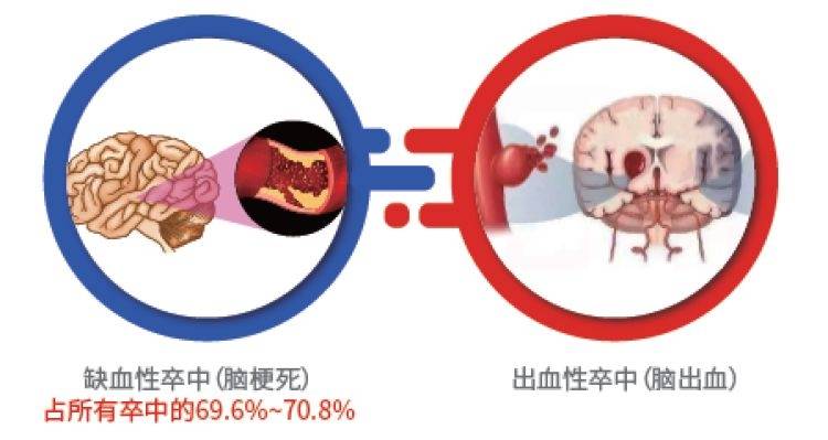 90%以上的卒中，其实可以预防！ 控制 患者 急救