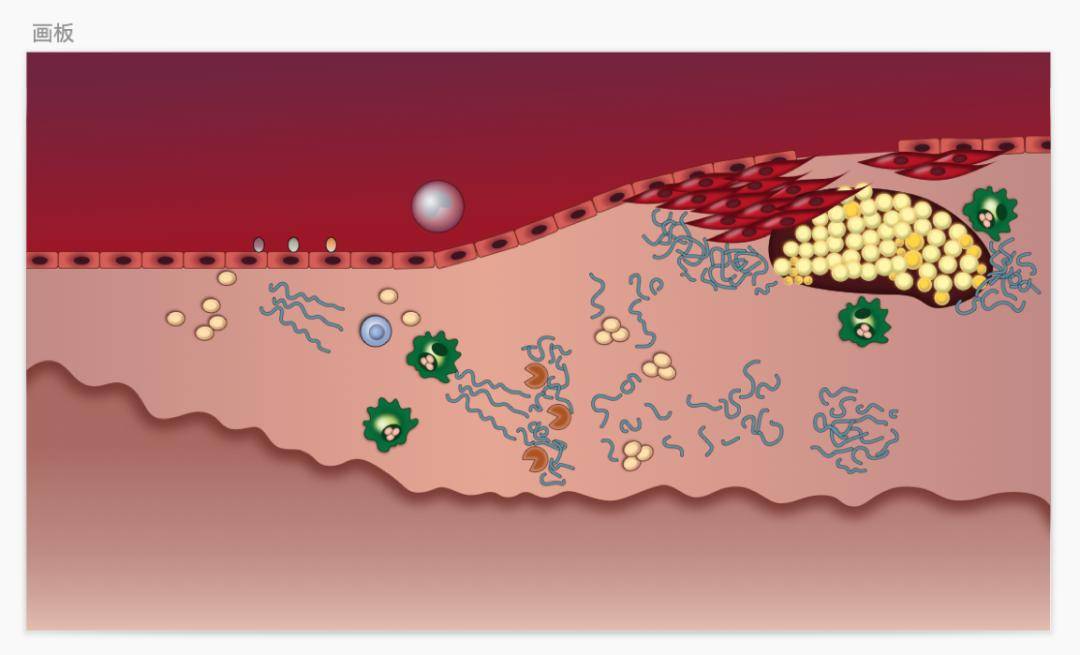 科研绘图-动脉粥样硬化4