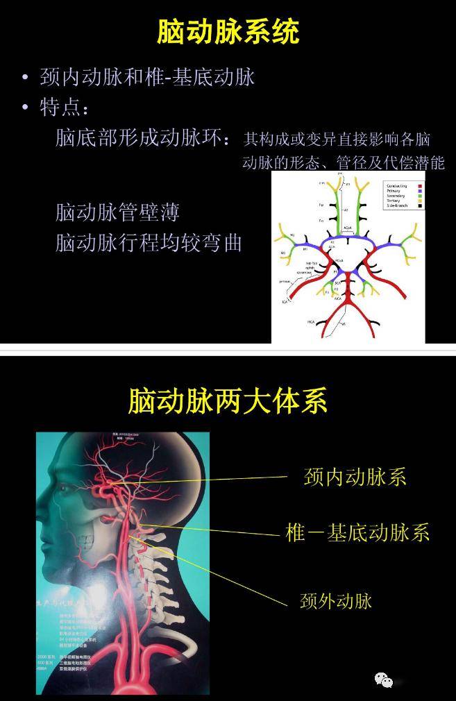 脑动脉丨正常变异