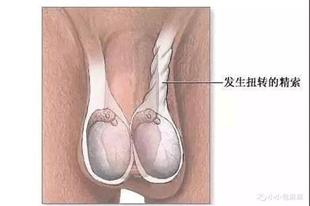 「睾丸」家有儿子一定要看又一起悲剧！男孩“蛋疼”1天致坏死